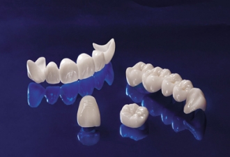 Bọc răng sứ với kĩ thuật cấy ghép Implant